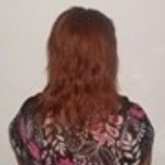 Carolyn Evans-Frost Before Hair Loss Treatments