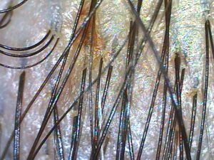 Scalp Treatment with Absolique Trichologist After