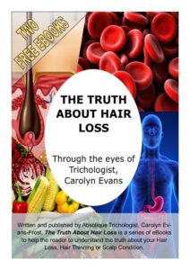 Hair Loss, Hair Thinning, The Difference, Free eBook