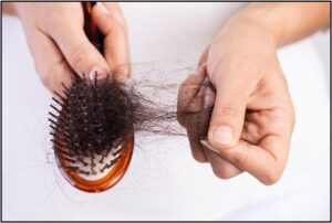 Hormonal Hair Loss vs Pattern Hair Thinning, Birth Control and Medications