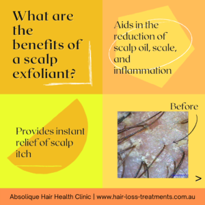 Scalp treatment before