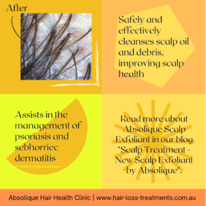 Scalp treatment after