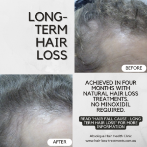 Hair fall cause - long term hair loss