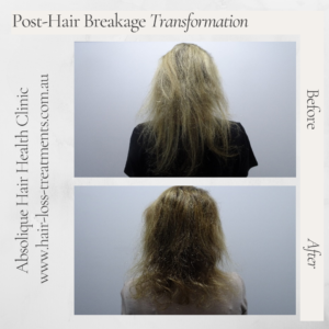 Hair breakage - Why is my hair breaking?